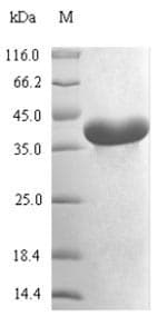 Mycoplasma pneumoniae map/Methionine Aminopeptidase Protein (Recombinant 6His-SUMO, N-terminus)