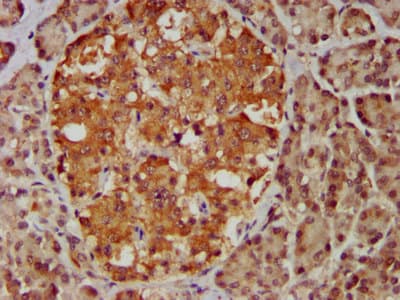 Polyclonal Rabbit anti-Human MBIP Antibody (IHC)