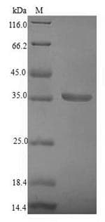 Lysobacter enzymogenes Beta-lytic metalloendopeptidase Protein (Recombinant 6His-SUMO, N-terminus)
