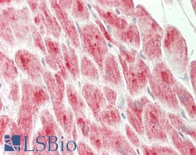 IHC-plus™ SLC9A6 Antibody (aa600-650)