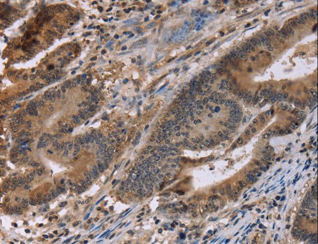 Polyclonal Rabbit anti-Human FAM107A / TU3A Antibody (IHC)