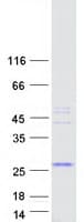 Human SAMD5 Protein (Recombinant Myc-DDK (Flag))