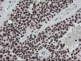 Monoclonal Mouse anti-Human TPRKB Antibody (clone OTI1E9, IHC, WB)
