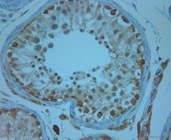 KCNJ13 / KIR7.1 Antibody (aa2-50)