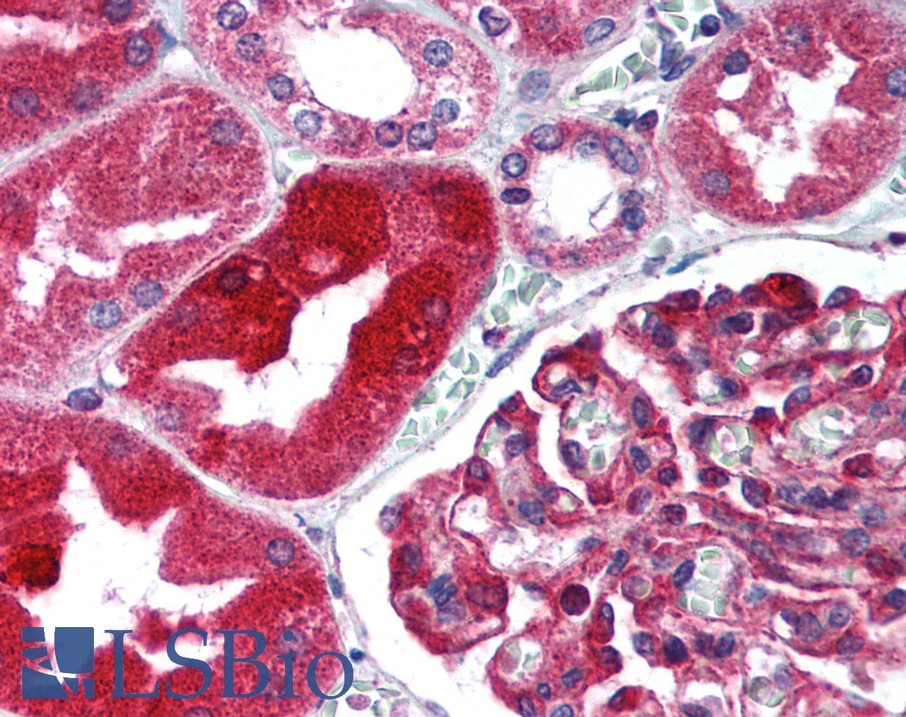 IHC-plus™ Polyclonal Rabbit anti-Human TJP1 / ZO-1 Antibody (aa463-1109, IHC, WB)
