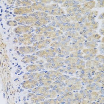 Polyclonal Rabbit anti-Human EFHC1 Antibody (IHC, WB)