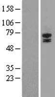STRA6 Protein (Over-Expression Lysate Myc-DDK (Flag))