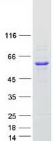 Human KLHL42 / KLHDC5 Protein (Recombinant Myc-DDK (Flag))