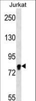 EIF4B Antibody
