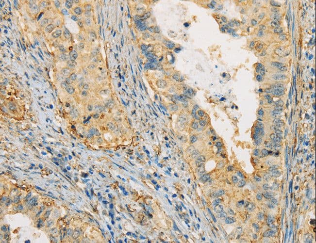 Polyclonal Rabbit anti-Human APOA4 Antibody (IHC)