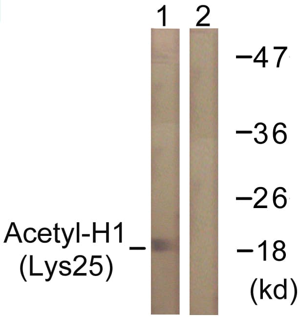 Histone H1 Antibody (Acetyl-Lys25)