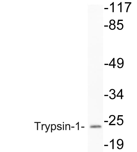 PRSS1 / Trypsin Antibody (Met109)