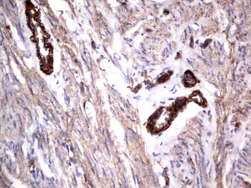 MCAM / CD146 Antibody (clone UMAB154)