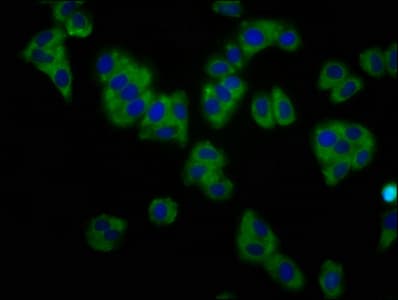 KCNT1 / KCa4.1 Antibody