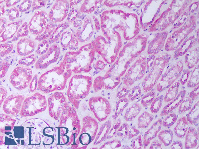 IHC-plus™ Polyclonal Rabbit anti-Human TNFRSF1B / TNFR2 Antibody (IHC, WB)