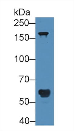 POTEG Antibody (aa177-330)