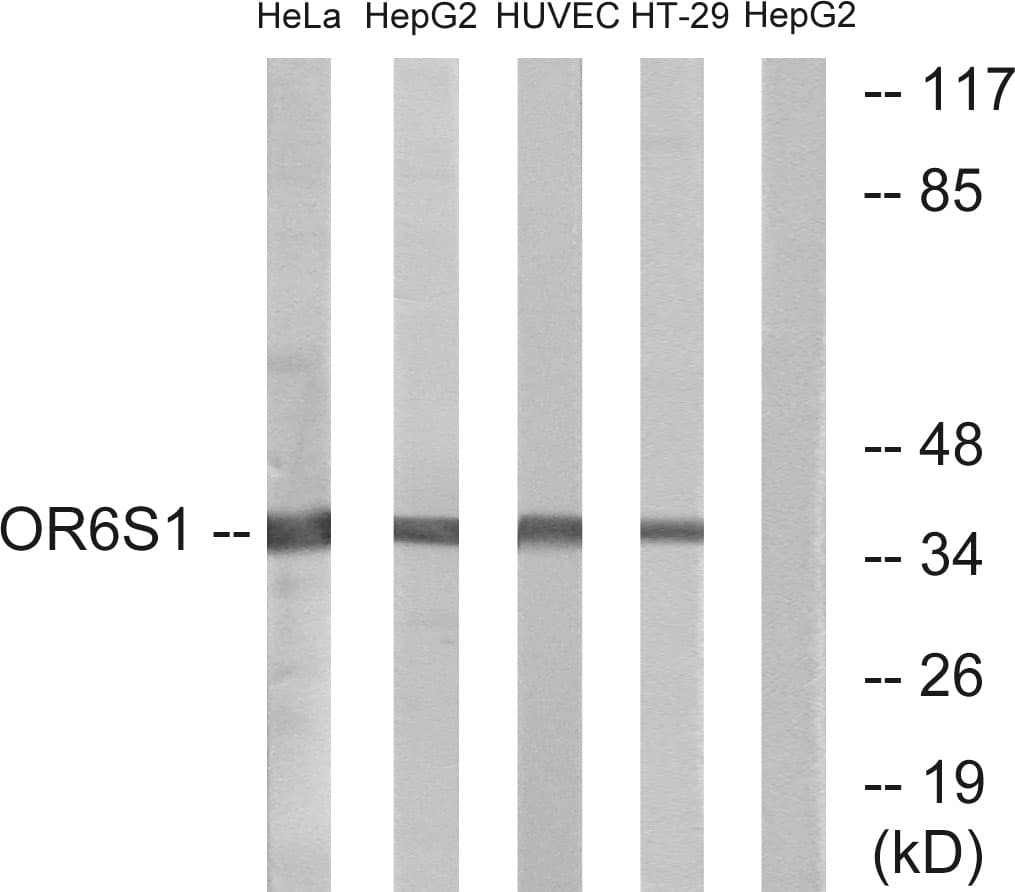 OR6S1 Antibody (aa165-214)