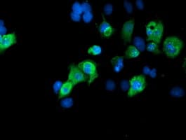 Monoclonal Mouse anti-Human SENP2 Antibody (clone OTI1D7, IHC, IF, WB)