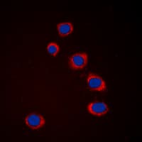 MAP3K8 / TPL2 Antibody (Internal)
