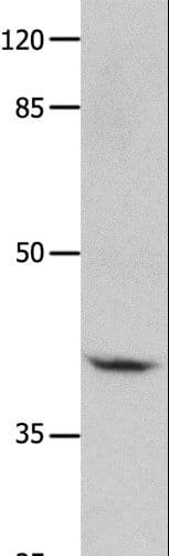 GNA11 Antibody