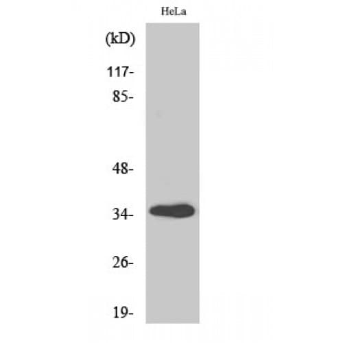 GIMAP5 Antibody (200-280 aa, C-terminal)