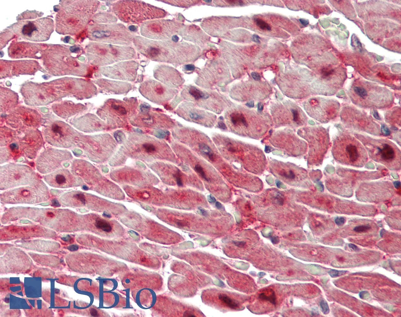 TBXT / T / Brachyury Antibody (aa251-300)