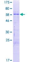 Human ZNF524 Protein (Recombinant GST)