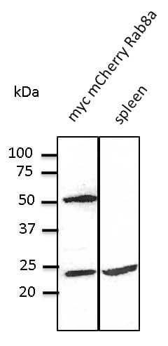 IHC-plus™ RAB8A / RAB8 Antibody (C-Terminus)