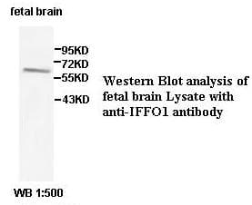 Polyclonal Rabbit anti-Human IFFO / IFFO1 Antibody (aa320-536, IHC, WB)