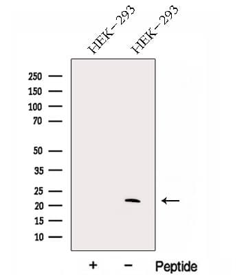 GM2A Antibody
