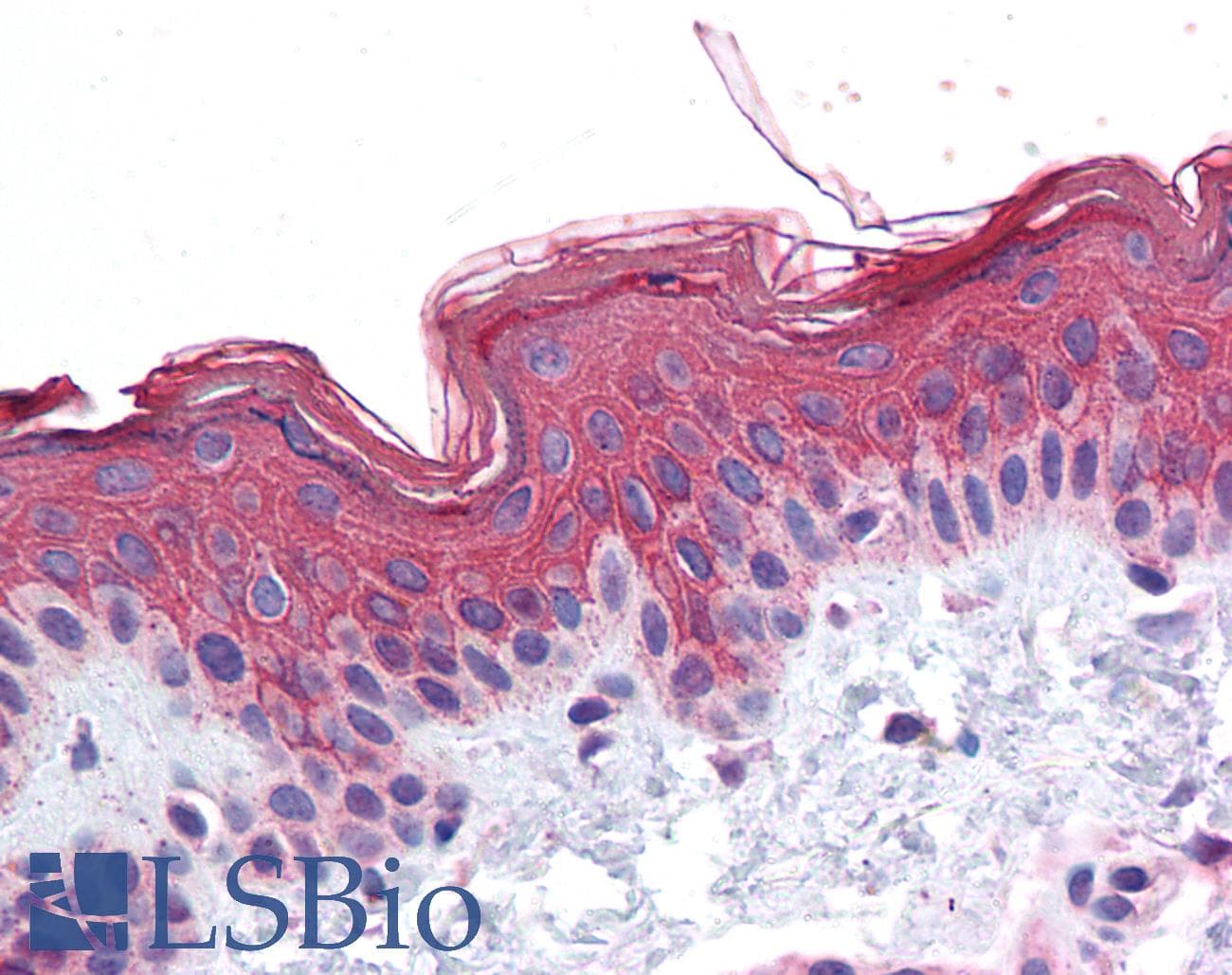 IHC-plus™ ADAM17 / TACE Antibody (C-Terminus)
