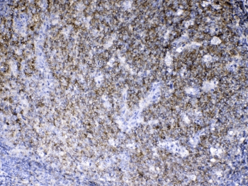 LYN Antibody