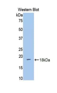 DPP4 / CD26 Antibody (aa631-760)