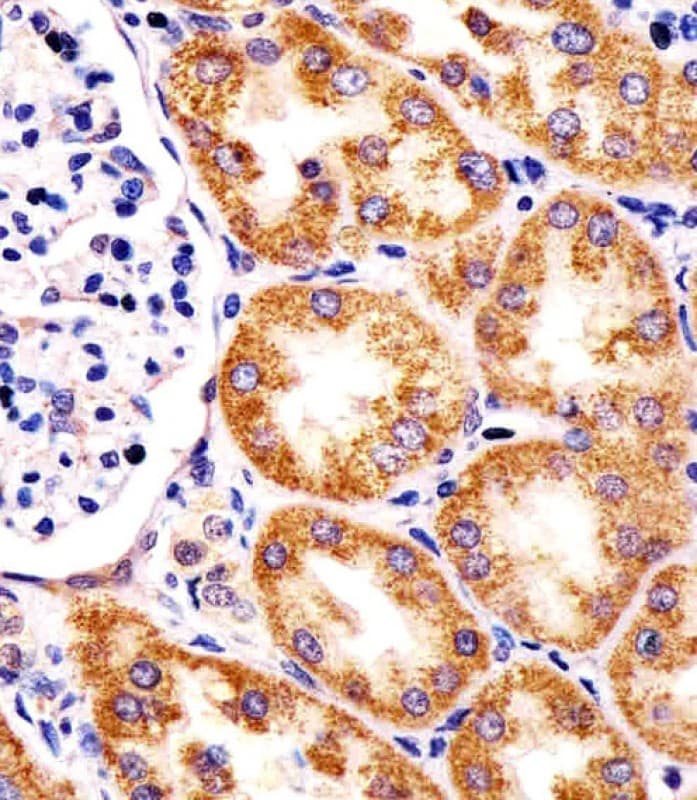 Polyclonal Rabbit anti-Human Rhodanese / TST Antibody (aa170-203, IHC, WB)