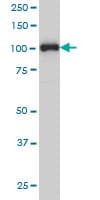 PR / Progesterone Receptor Antibody (clone 3E11)