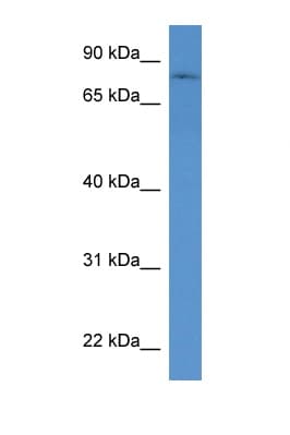 Polyclonal Rabbit anti-Mouse POMGNT1 Antibody (aa47-96, WB)