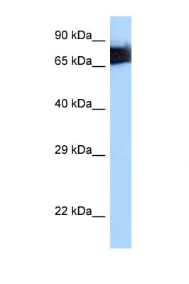 Polyclonal Rabbit anti-Human MSN / Moesin Antibody (aa494-543, WB)