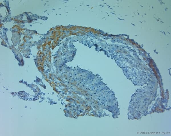 TJP2 / ZO2 / ZO-2 Antibody (aa740-790)