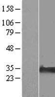 NIPA2 Protein (Over-Expression Lysate Myc-DDK (Flag))