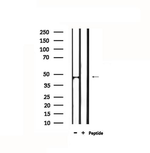 Polyclonal Rabbit anti-Human IL18BP Antibody (IF, WB)