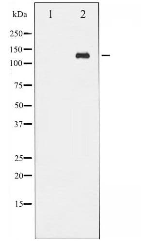 Polyclonal Rabbit anti-Human ABL1 / c-ABL Antibody (phospho-Tyr412, IHC, WB)