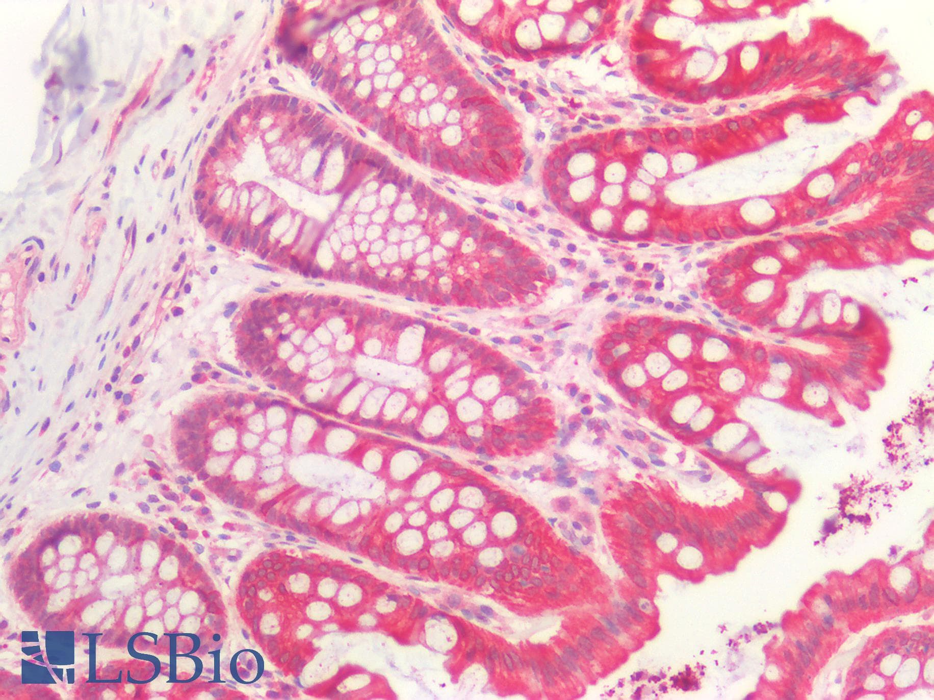 IHC-plus™ NRAS / N-ras Antibody