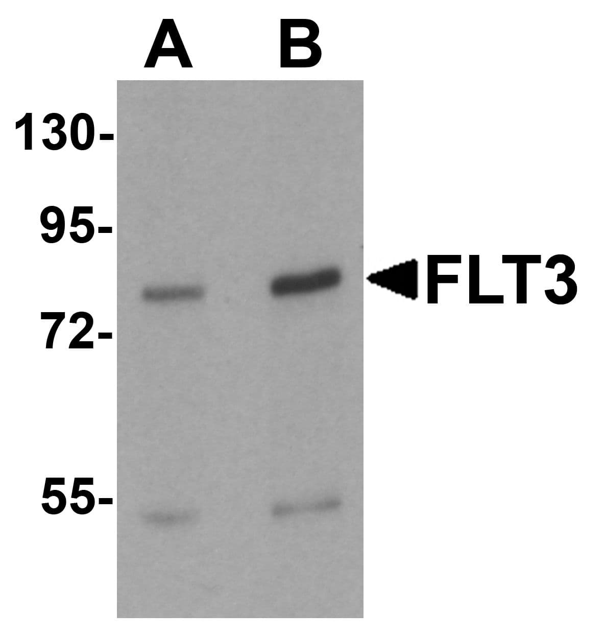 IHC-plus™ CD135 / FLT3 Antibody