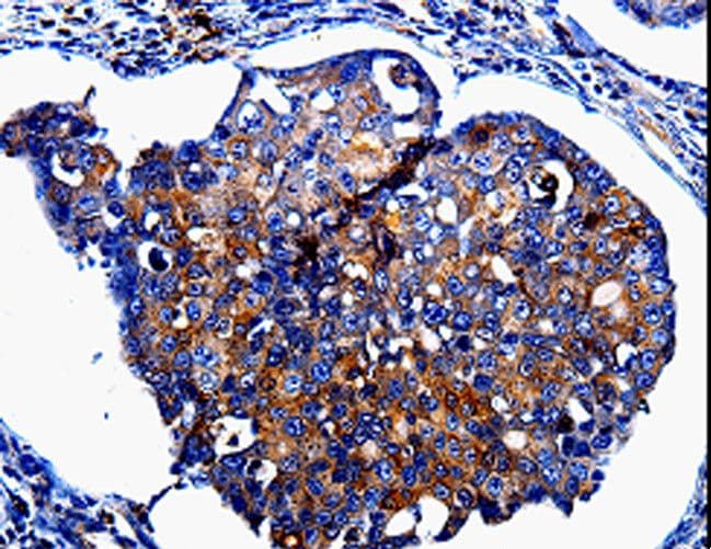 IL10RB Antibody