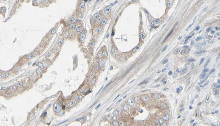 GRAP Antibody