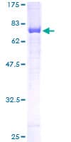 Human SERPINF1 / PEDF Protein (Recombinant GST)