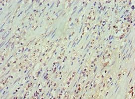 CD20 Antibody (aa208-297)