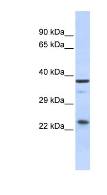 SERTAD1 / TRIP-Br1 / SEI-1 Antibody (aa35-84)