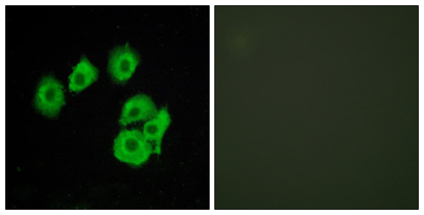 IHC-plus™ CYSLTR1 / CYSLT1 Antibody (aa131-180)