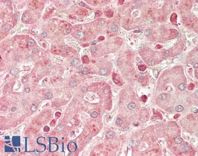 IHC-plus™ STK25 Antibody (aa1-426)